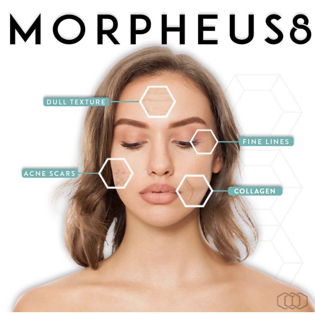 Morpheus8 Microneedling Fractional Treatment for Skin Rejuvenation