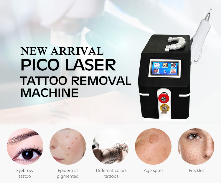 laser tattoo removal cost