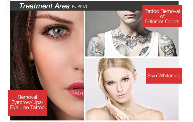 laser eyebrow tattoo removal