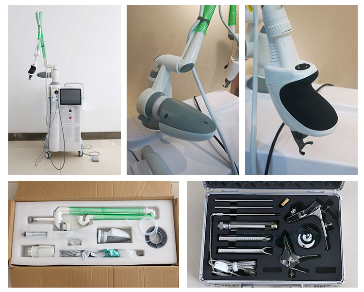 fractional co2 acne scars