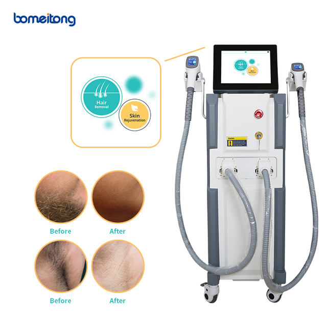 Lescolton 2in1 Ipl Different Types of Laser Hair Removal Price Elos Alma