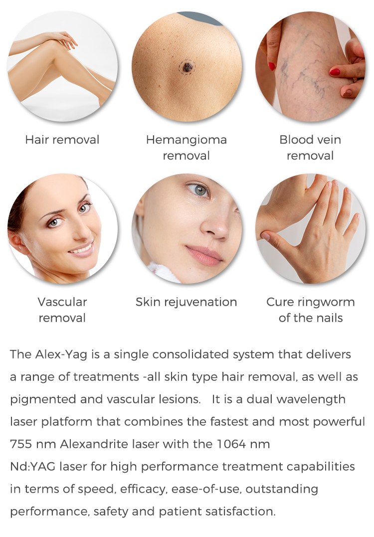 laser hair removal