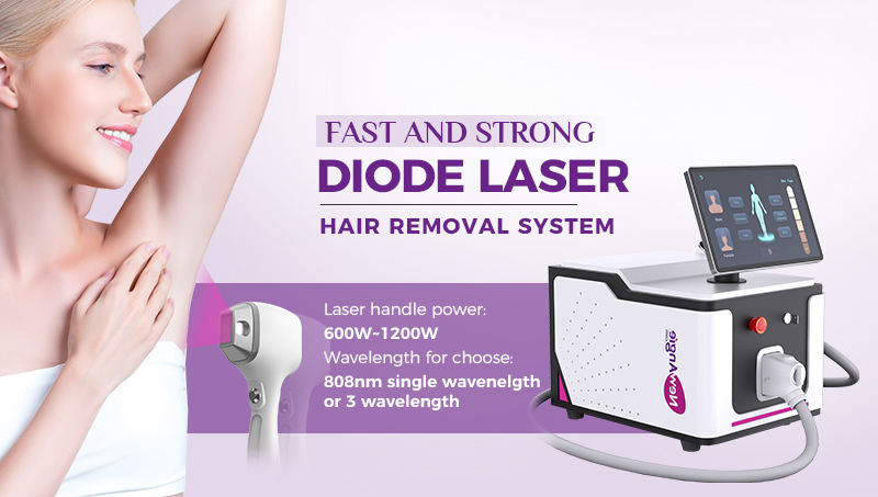 diode laser hair removal