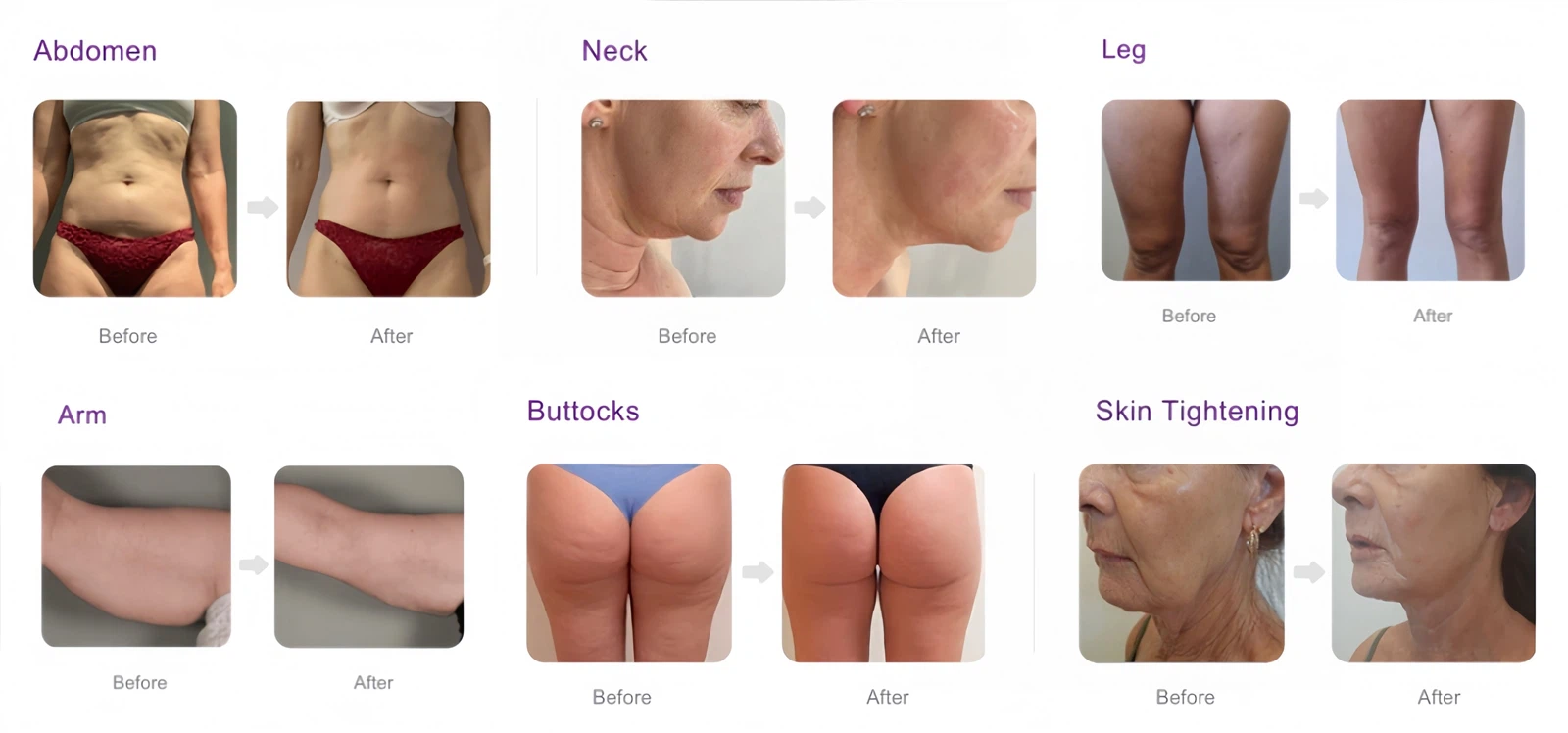 608a149a46284b3f8507e93d8cf3a8ba