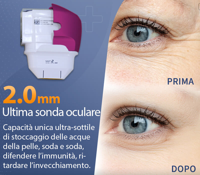 Cartucce per macchine hifu da 2,0 mm