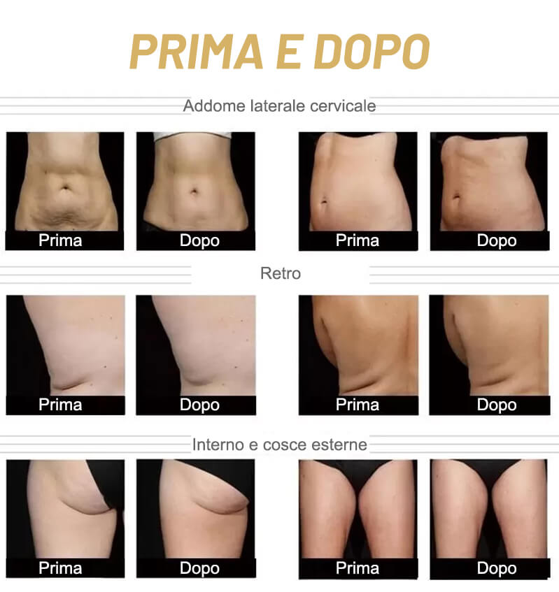 Effect comparison endosphères