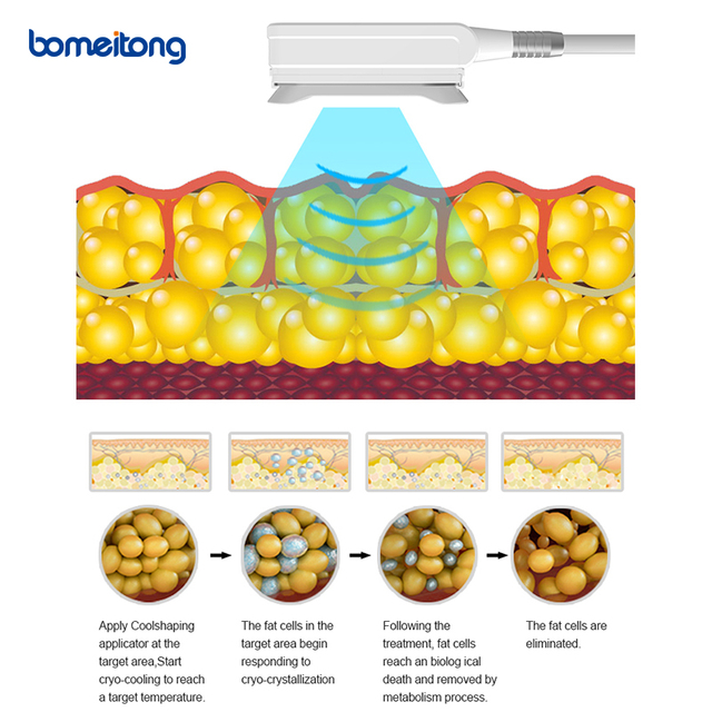Professional Cryolipolysis Cryo Lipo Machine Price