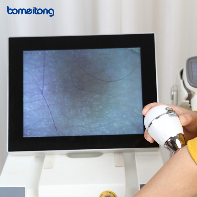 Laser hair removal diode machine 755 808 1064 3 wave wavelength professional