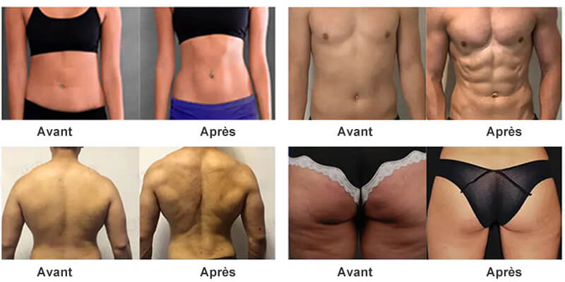 Comparaison des effets