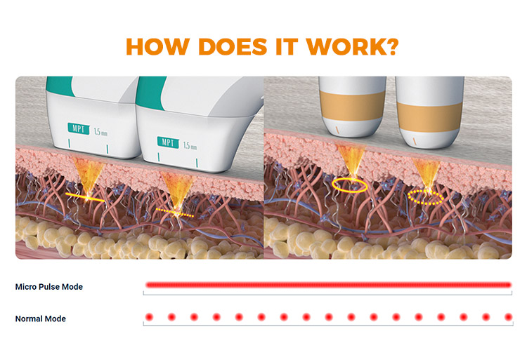 how does mmfu tcp work