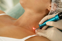 //ikrorwxhqkrili5q.ldycdn.com/cloud/ljBplKiolmSRilrlmplpip/pico-laser-benefits.jpg