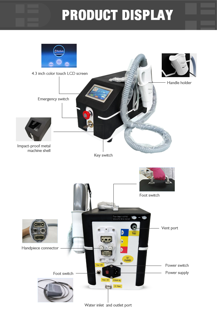 tattoo removal reddit