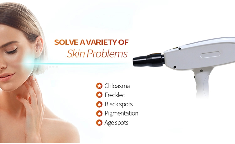 nd yag laser for acne scars