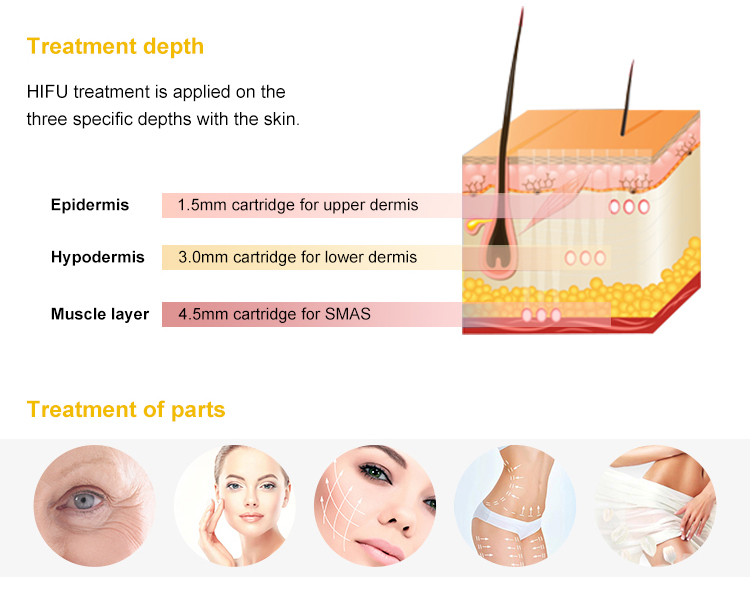4Dhifu treatment depth