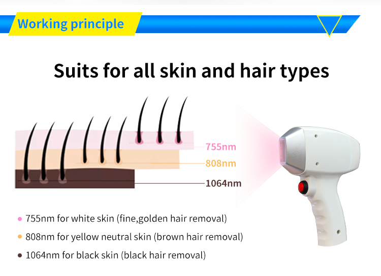 soprano ice laser hair removal price