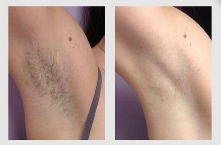 Comparison of before and after use