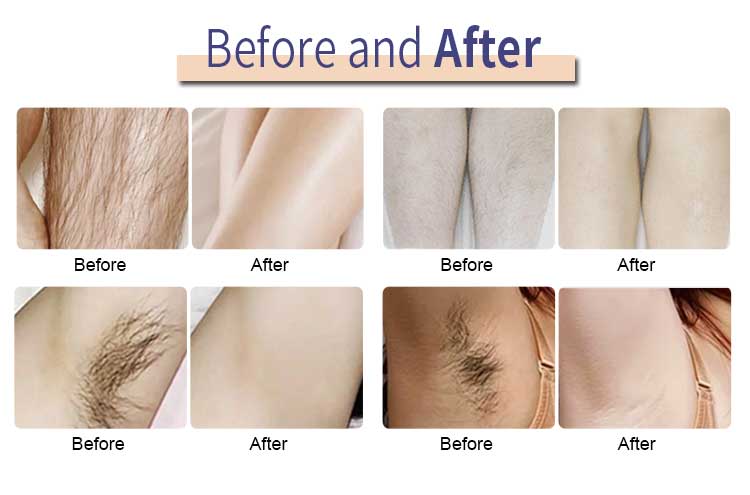 Comparison of before and after use