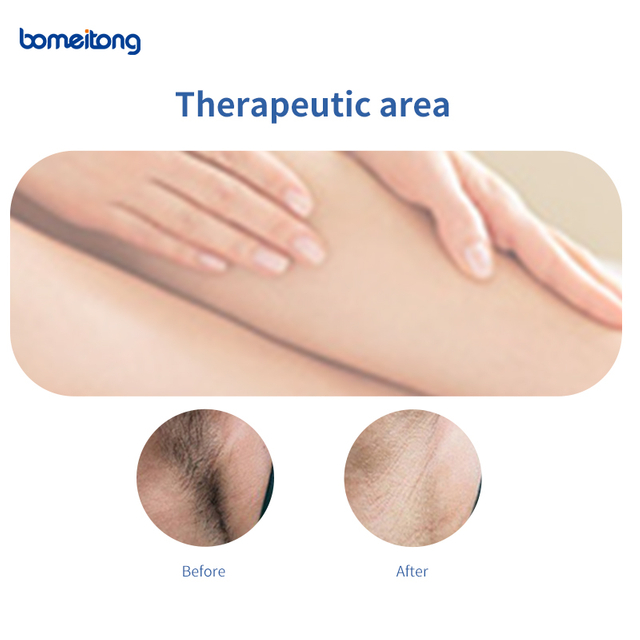 Best Commercial Laser Machine for Facial Hair Removal Women's Painless