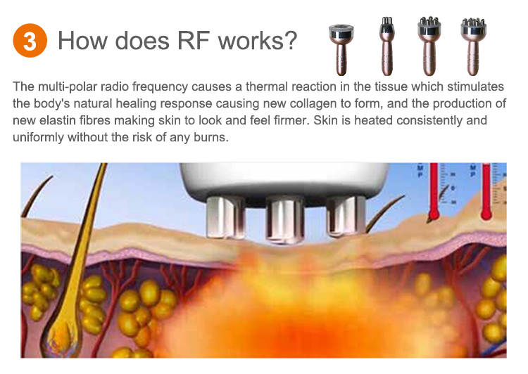 body sculpting cavitation machine