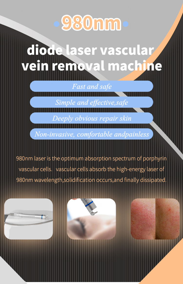 spider vein treatment costs