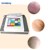 980nm Diode Laser Vescular Vein Removal Machine Spider Vein Amazon Ipl