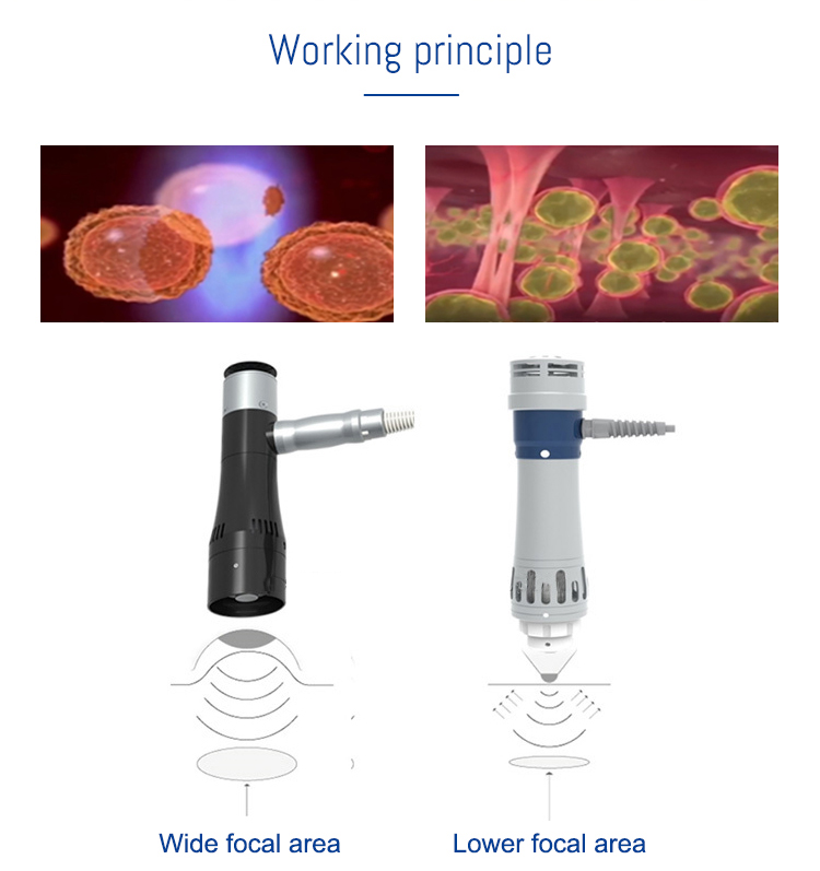 shockwave therapy machine
