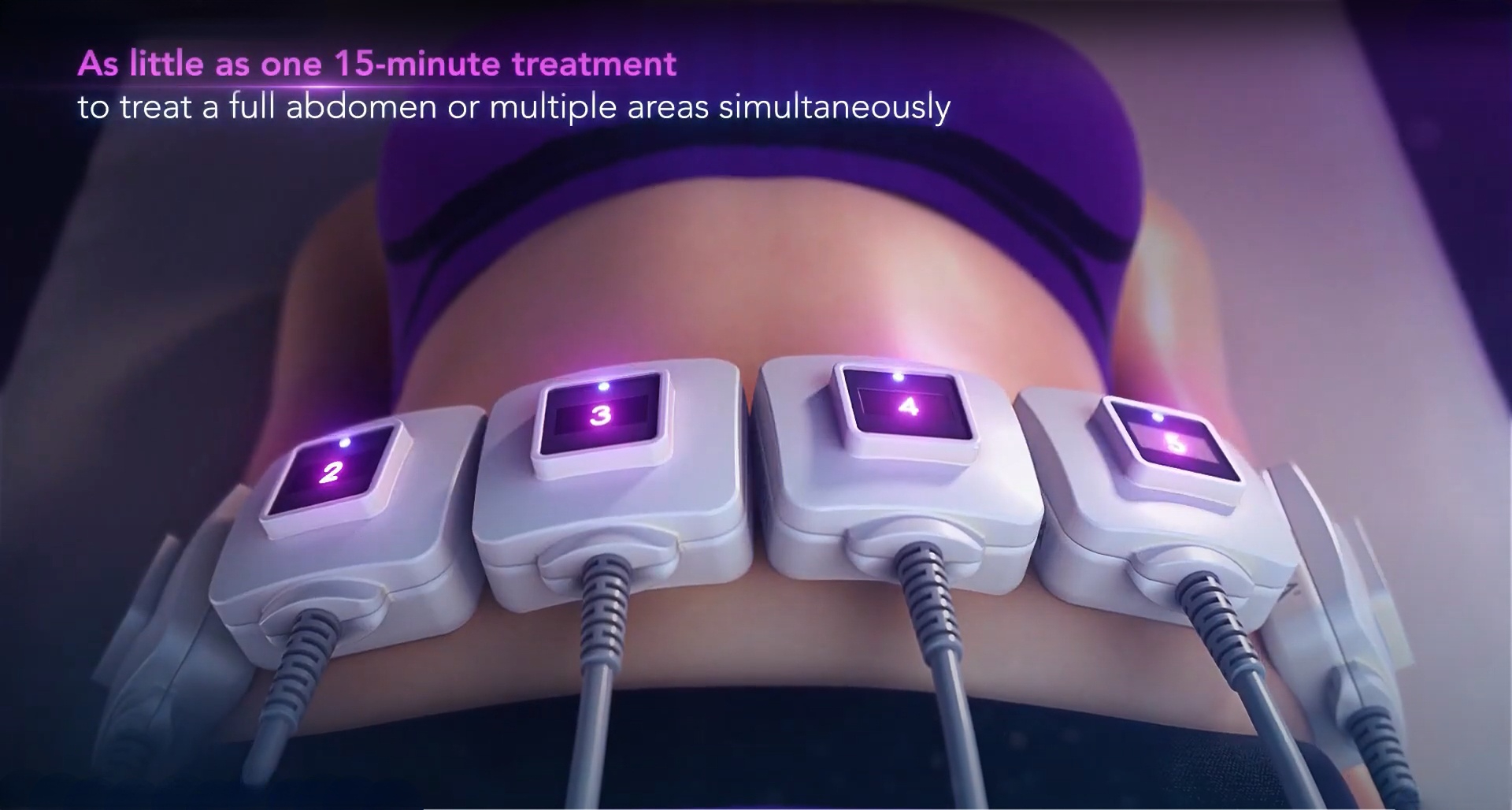 trusculpt id