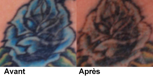 picosecond laser machine