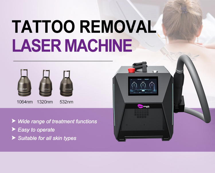 yag laser