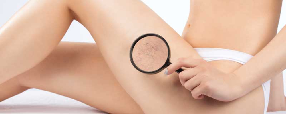 980nm Diode Laser Machine