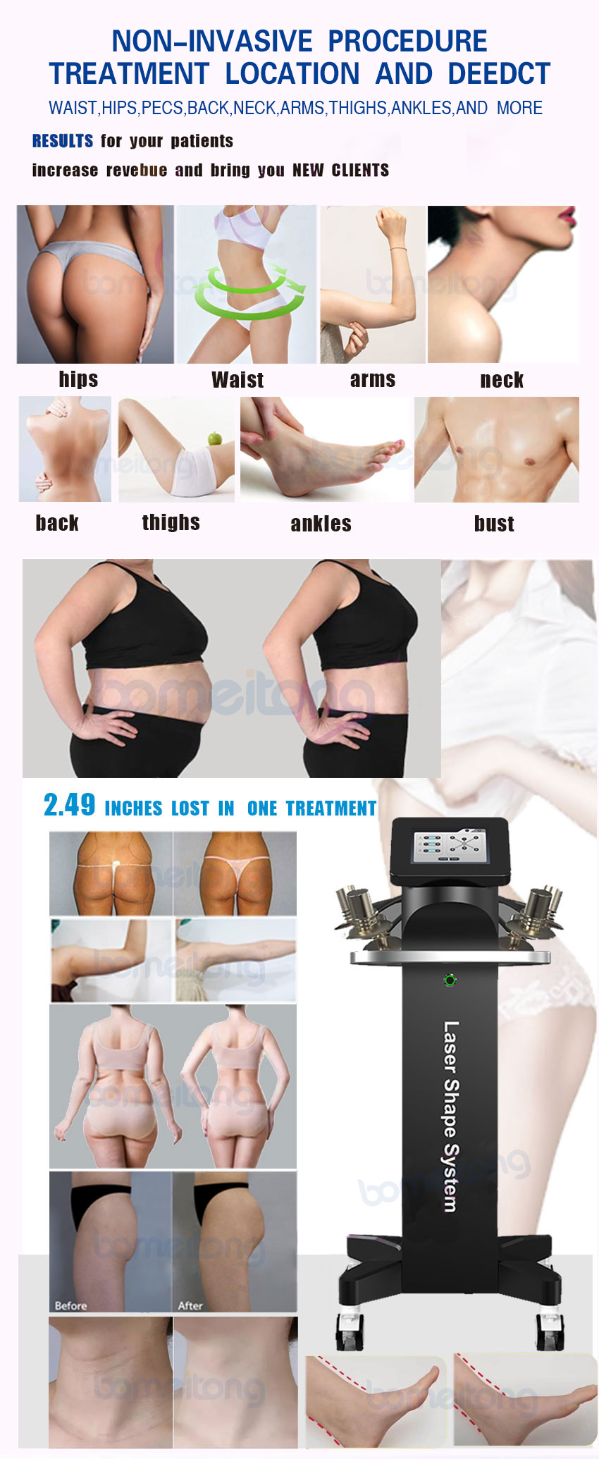 zerona machine verju 6d lipo laser slimming Green light red light weight loss LS656
