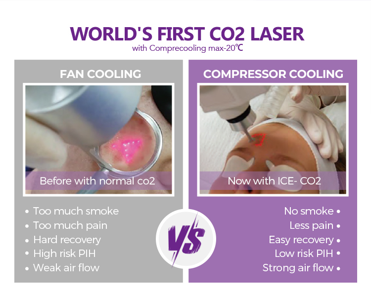 CO2 laser machine
