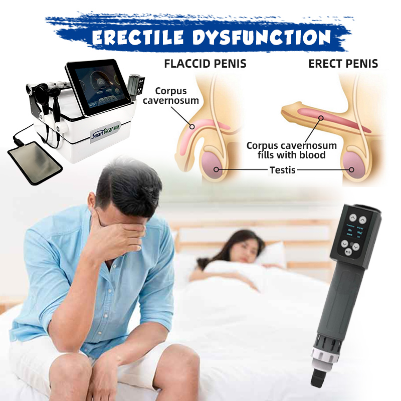 shockwave machine for ED