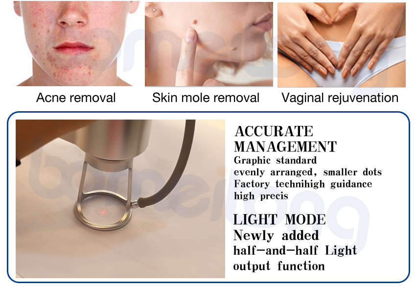 Fractional Co2 Laser Machine Cost Skin Resurfacing Acne Scars Stretch Marks Removal 