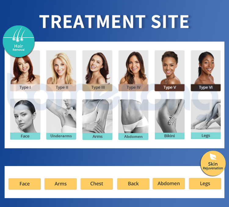 medical laser hair removal