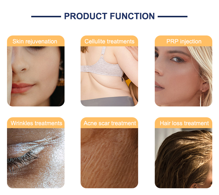 mattioli ce sistem dermoelectroporation dep