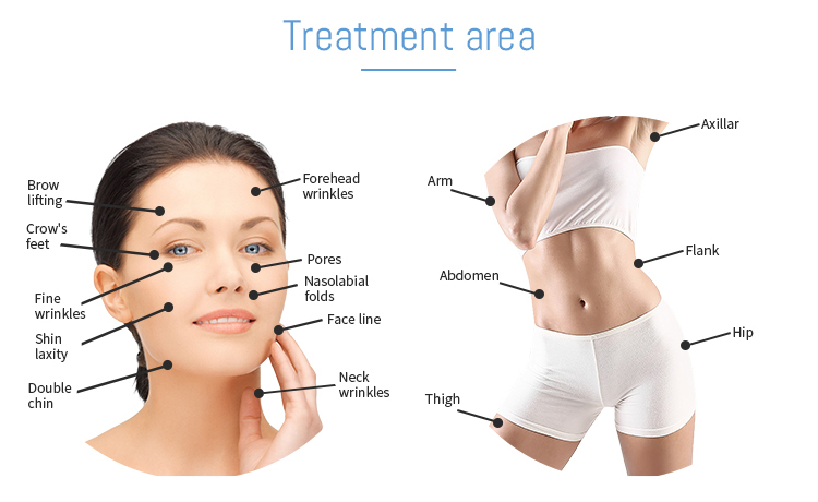 hifu face lifting machine