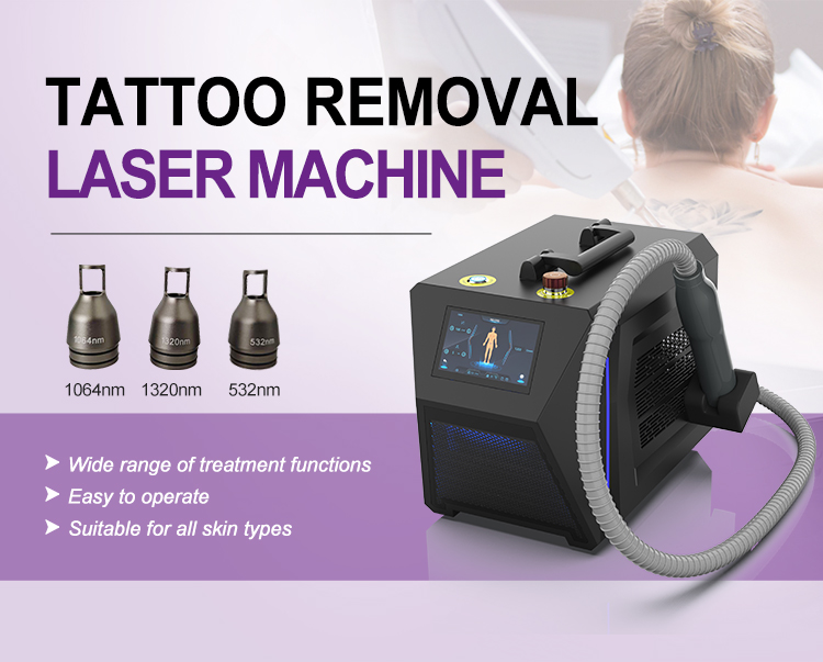 yag laser