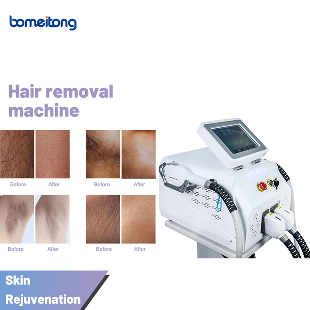 Laser Skin Rejuvenation Underarm Hair Removal Ipl Elight Machine