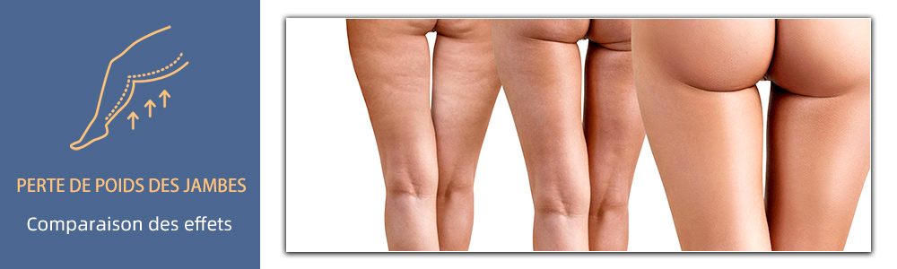 Comparaison des effets EMS