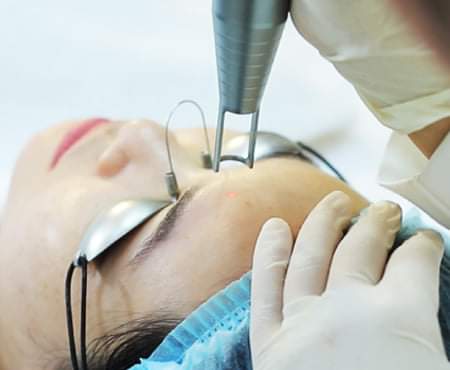 Scars & Acne Scars Treatments