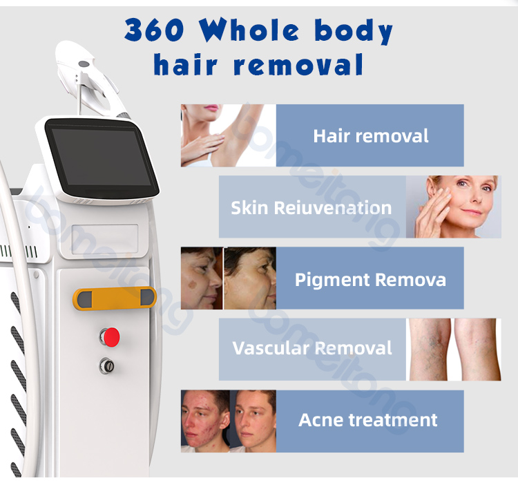 Best professional ipl laser hair removal machine SHR OPT DPL elight laser multifunctional double handle