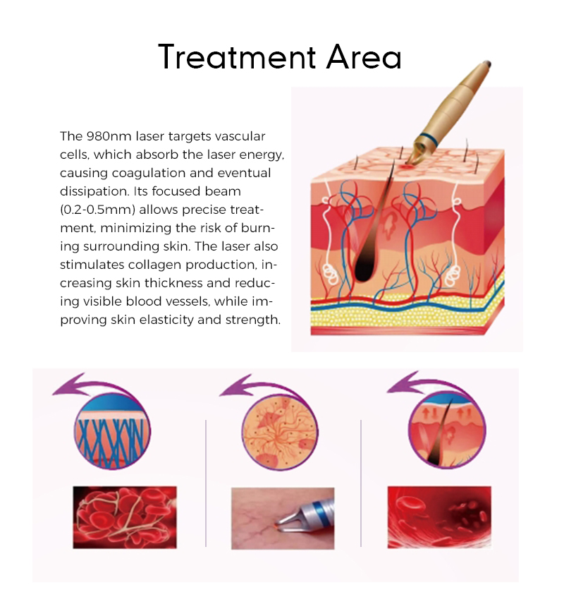 980 Physiotherapy Instrument with Diode Laser for Pain Relief And High-Intensity Therapy