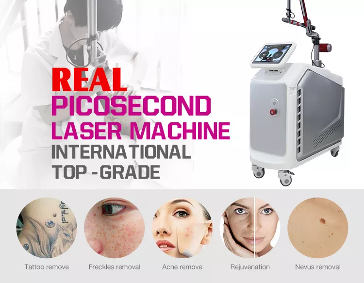 picosecond laser tattoo removal