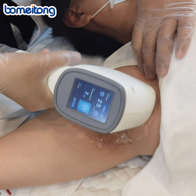 2022 Painless & Fast Hair Removal Silky Skin 808nmdiode Laser