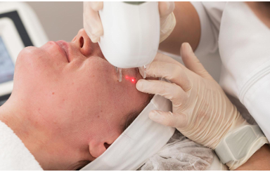 Why Choose Fractional CO2 Laser Machine?