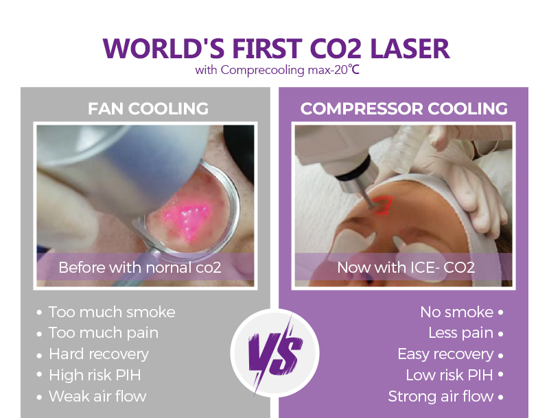 Fractional CO2 Laser Machine 60W Skin Rejuvenation Vaginal Tightening Laser Acne Scar Removal