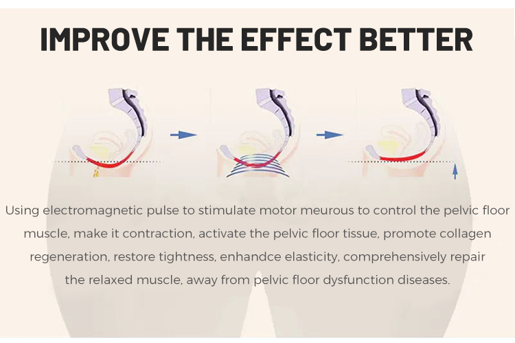 Pelvic floor muscle repair