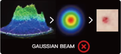 machine detatouage lumiere pulsee