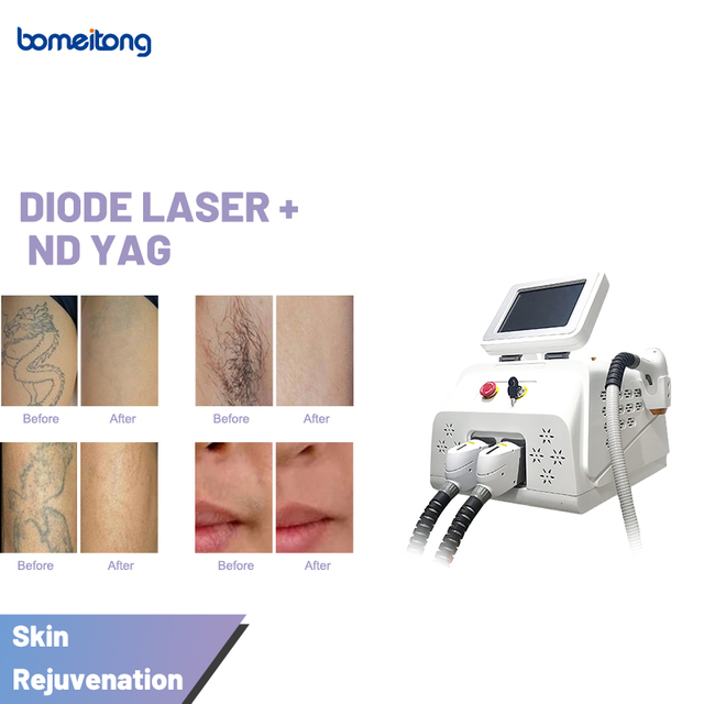 2 in 1 Hair Tattoo Removal Skin Rejuvenation Machine Cost